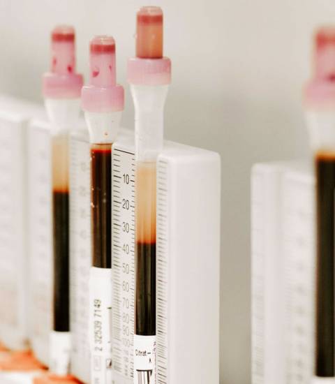 Labordiagnostik